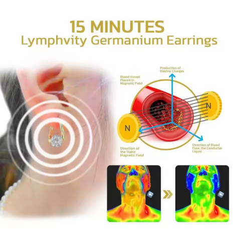 Lymph Earrings Lymphvity Germanium Ear Ornament Magnetherapy Weight Loss Earrings Lymphatic Earrings Gift for Girlfriend Wife - NATASHAHS